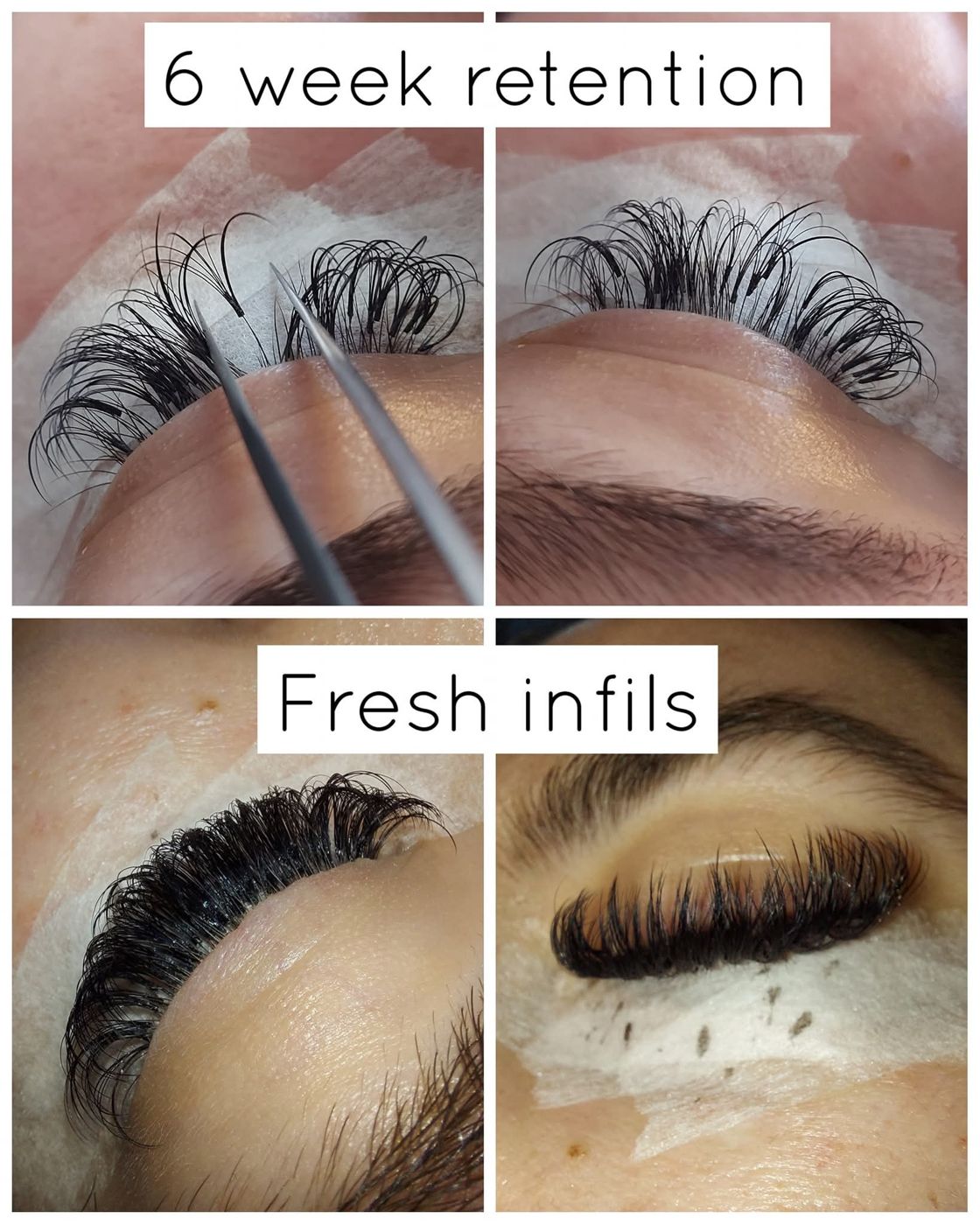 Lash extensions at six weeks and after infill