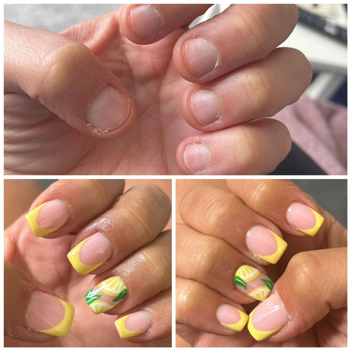 Bitten nails before, and lemon French nails after